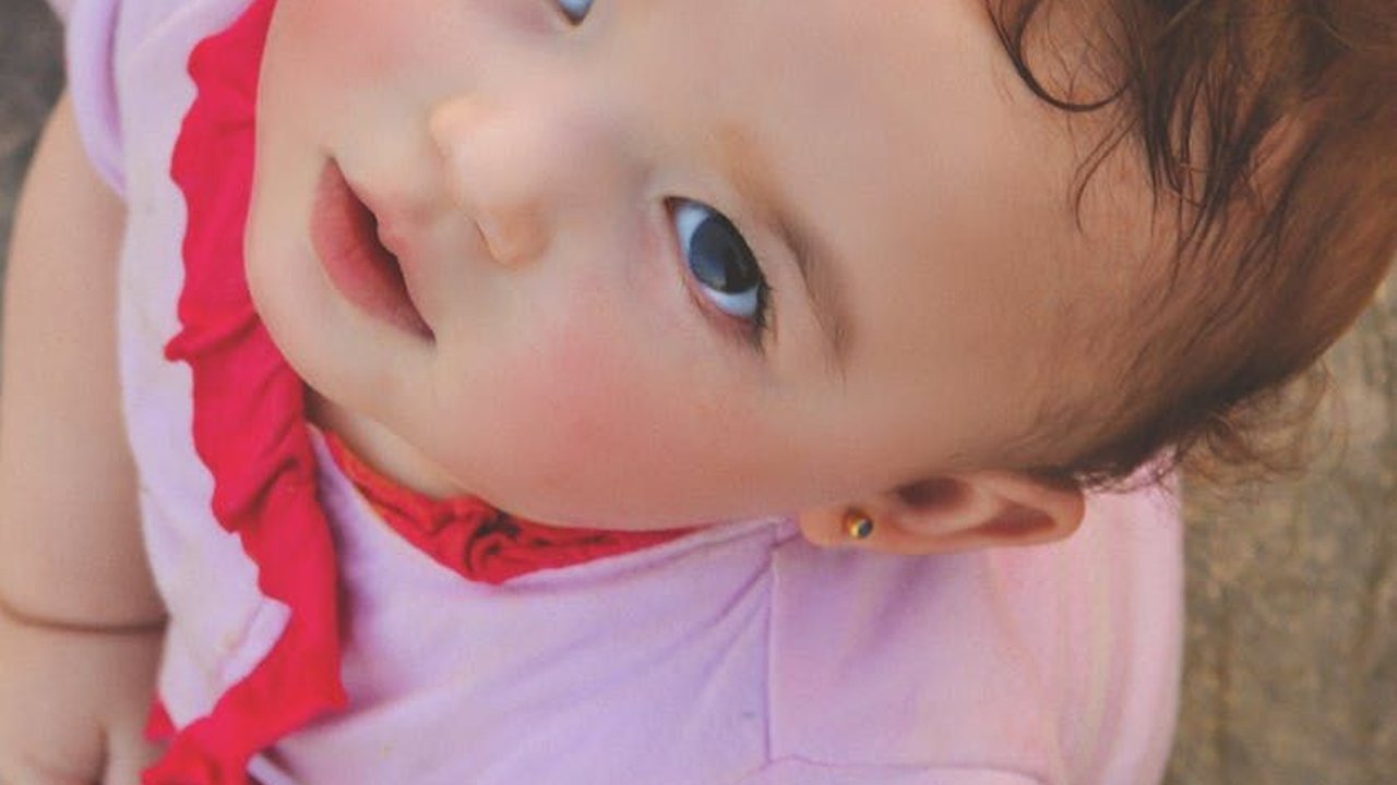 Ketahui Penyebab Bruntusan Pada Bayi dan Cara Menanganinya