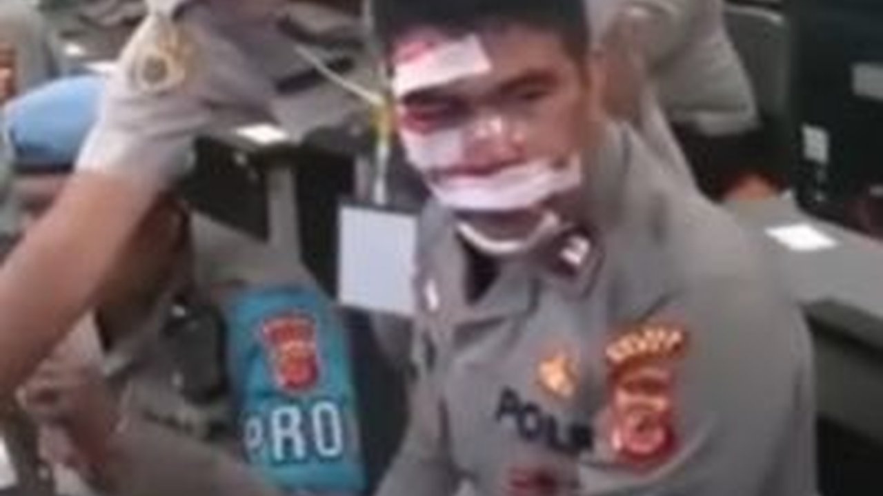 Muka Bonyok Penuh Luka dan Perban, Bintara Polri ini Gigih Ikut Tes Perwira, Hasilnya di Luar Dugaan