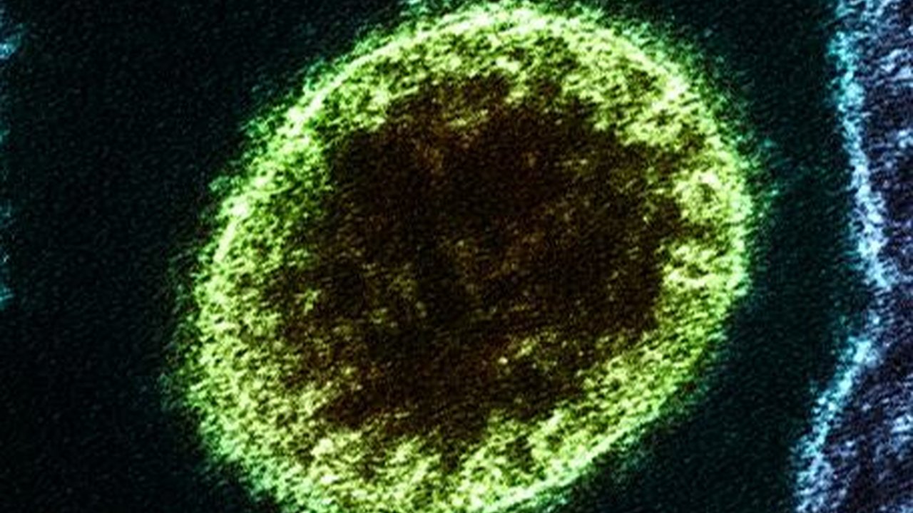 Gejala Virus Nipah yang Perlu Diwaspadai, Begini Cara Mencegahnya