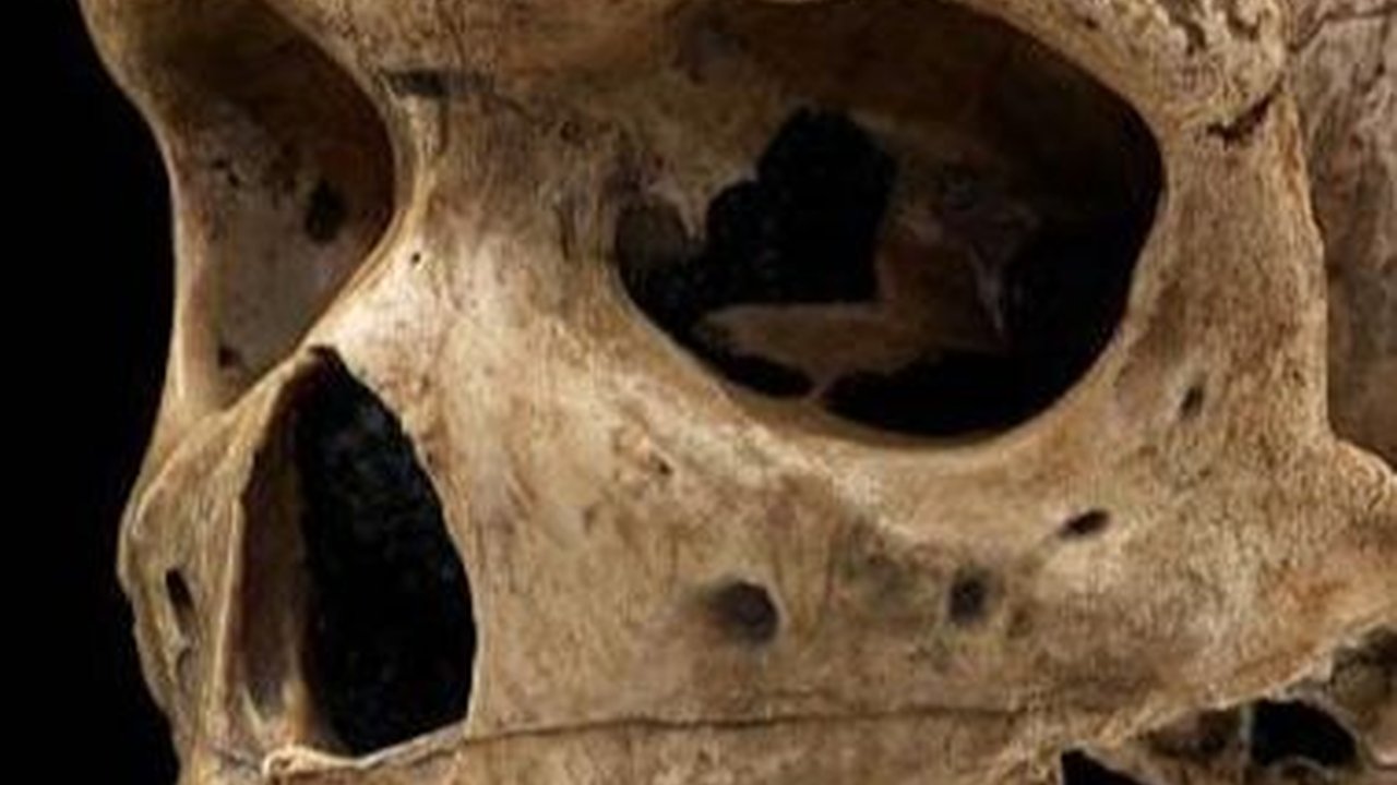 Misteri Lubang di Tengkorak Manusia Berusia 125.000 Tahun yang Mirip Luka Tembak, Arkeolog Dibikin Bingung