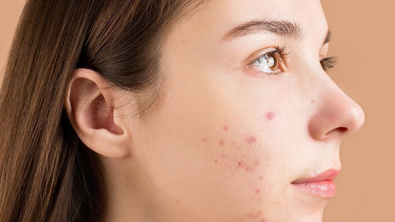 5 Ciri-ciri Skincare Tidak Cocok di Kulit yang Jarang Disadari, Kenali Tandanya