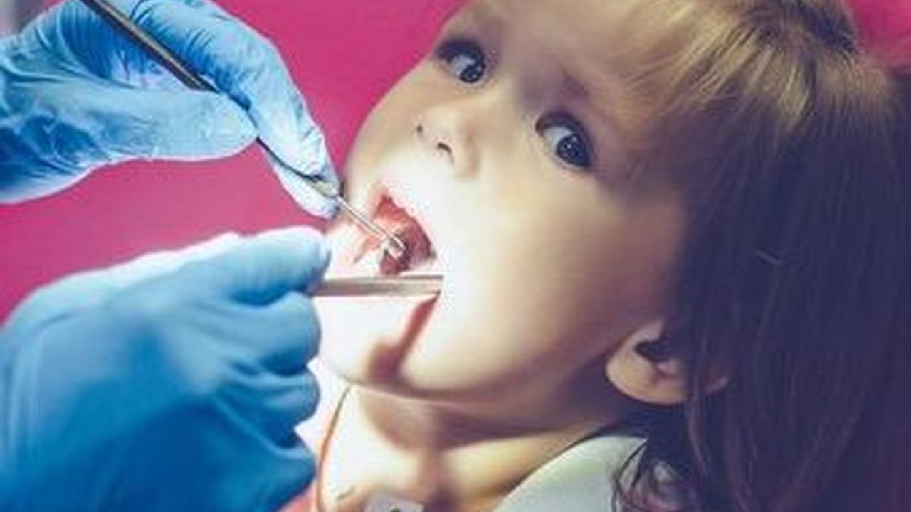 7 Penyebab Gigi Berlubang pada Anak Meski Rajin Gosok Gigi