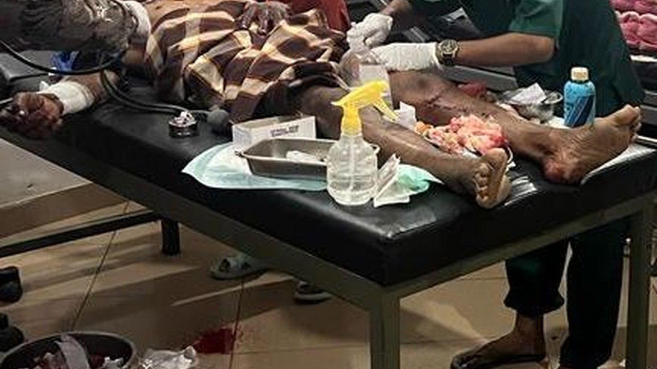 Lansia Diserang Beruang saat Bersihkan Kebun, Begini Kondisinya