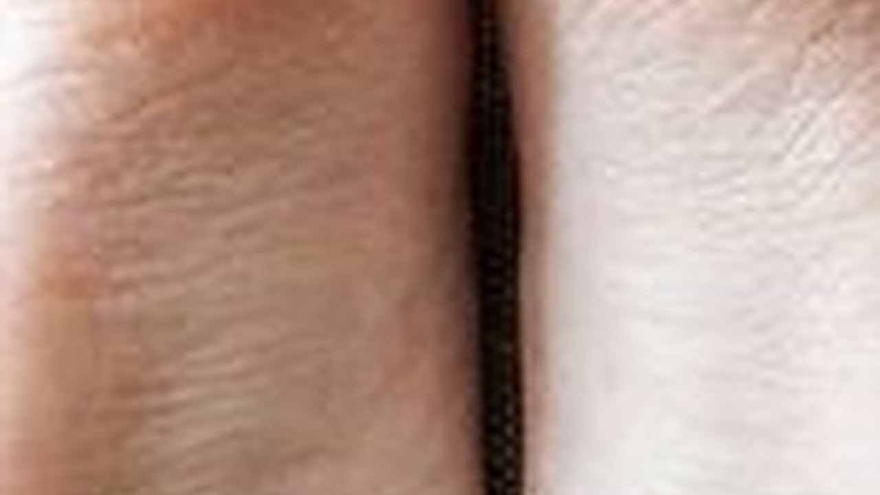 Gunakan 8 Bahan Alami Ini Untuk Hempas Tumit Pecah-pecah