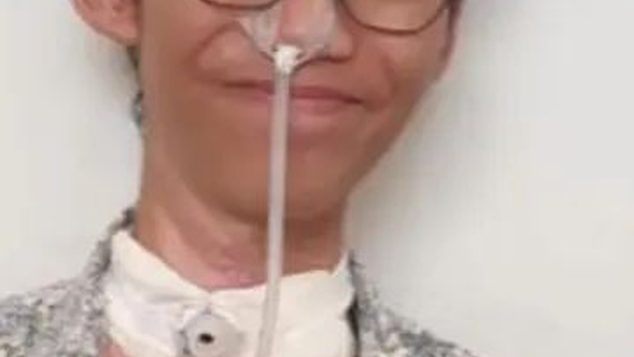 Sultan Korban Terjerat Kabel Fiber Sudah Bisa Bicara Usai Jalani Perawatan 245 Hari