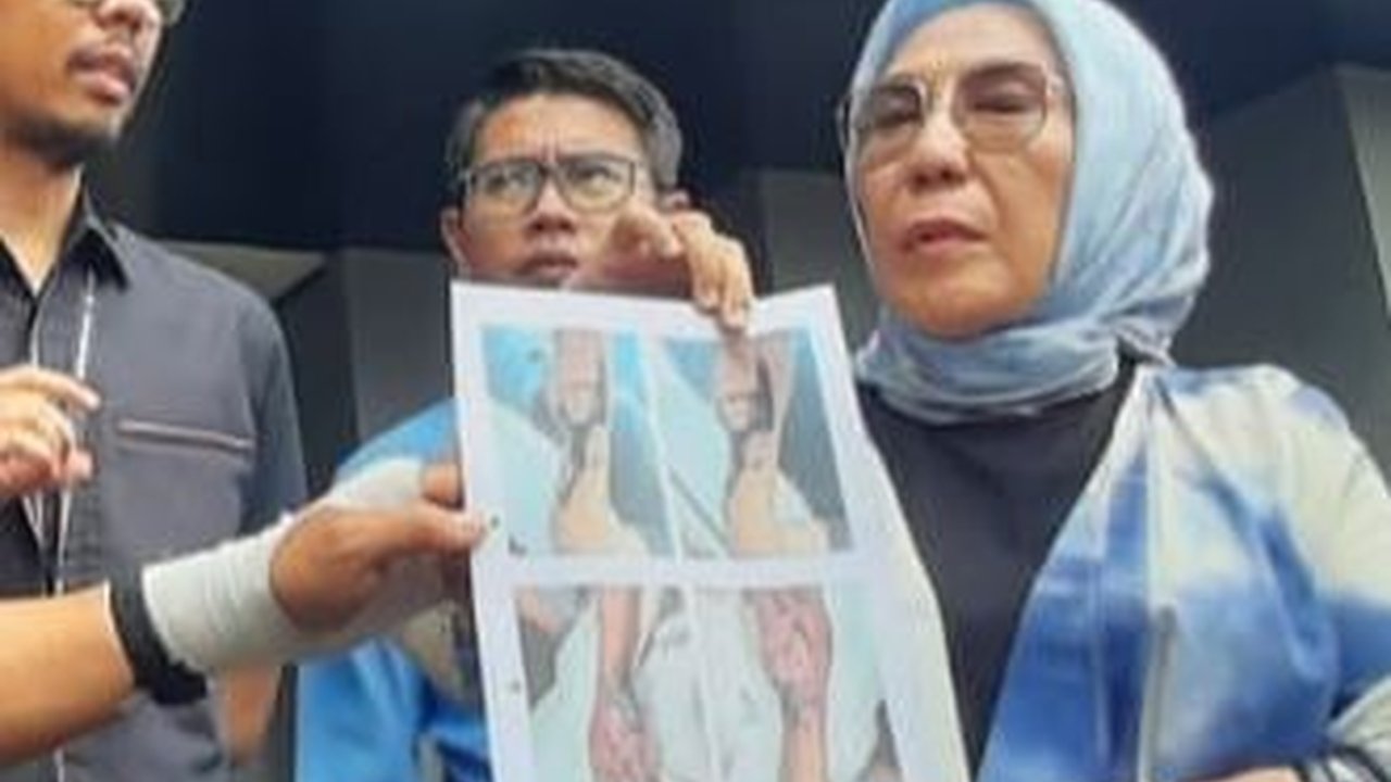 Diduga Jadi Korban Malpraktik, Tangan Pria Ini Membusuk Usai Diinfus