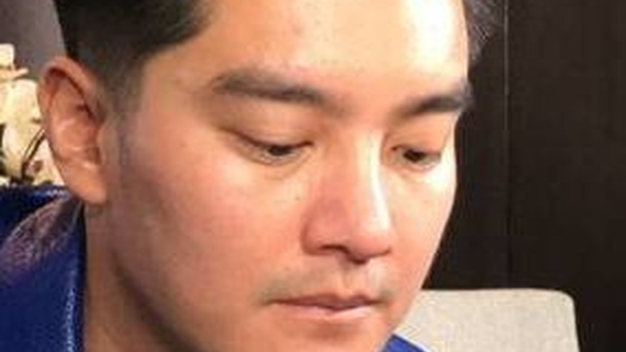 Boy William Ternyata Oplas Hidung Karena Alasan Medis, Kini Makin Mancung & Bikin Pangling