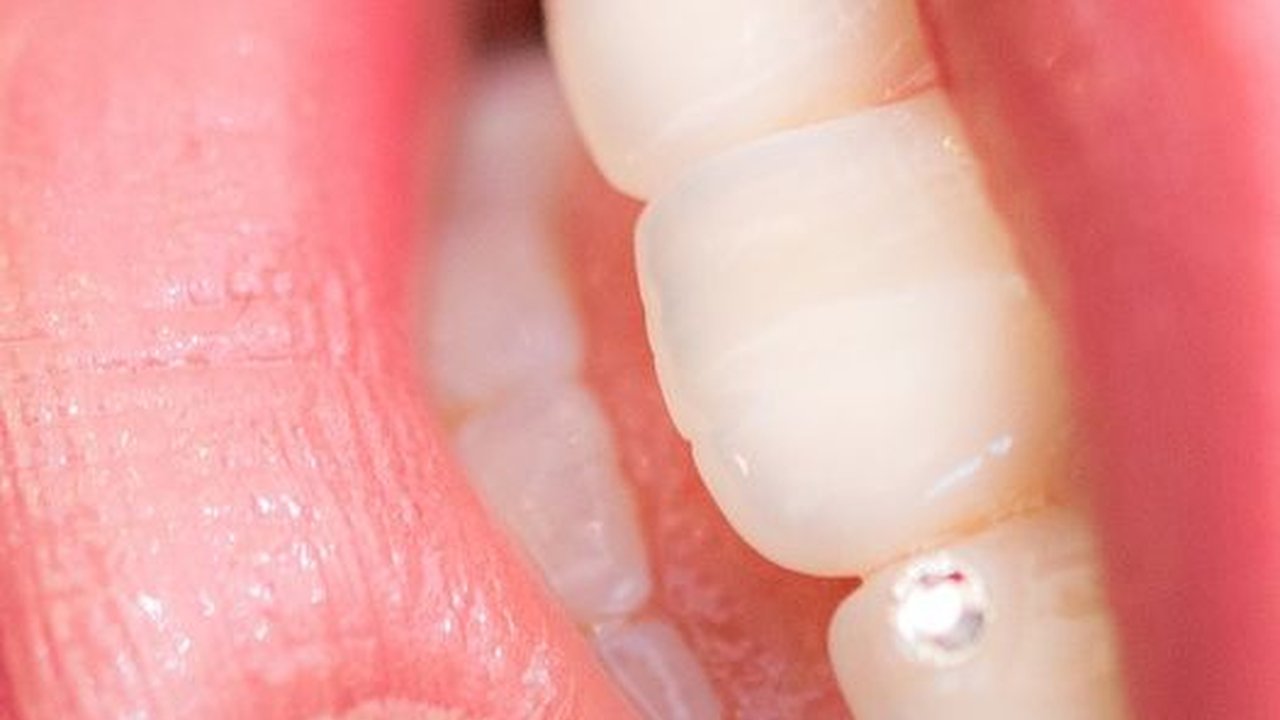 Viral Wanita Lakukan Sulam Bibir Demi Hemat Lipstik, Hasilnya di Luar Dugaan