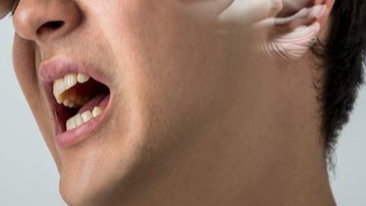 Mengenal Tahapan Penanganan Stroke hingga Waktu Emas Agar Terhindar dari Hal Buruk