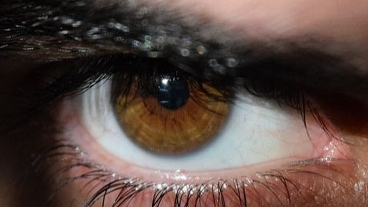 Mitos Mata Kedutan Sebelah Kanan, Pertanda Keberuntungan