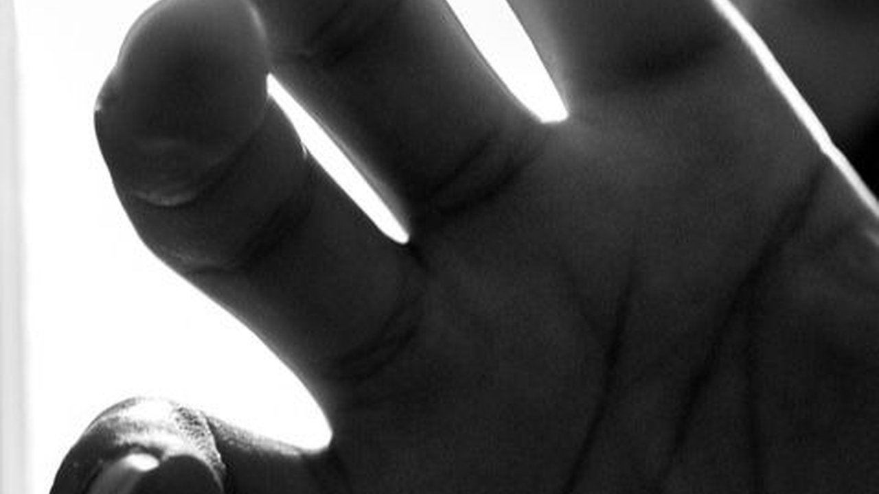 Penyebab Mata Ikan di Jari Tangan, Perhatikan Ciri-Cirinya