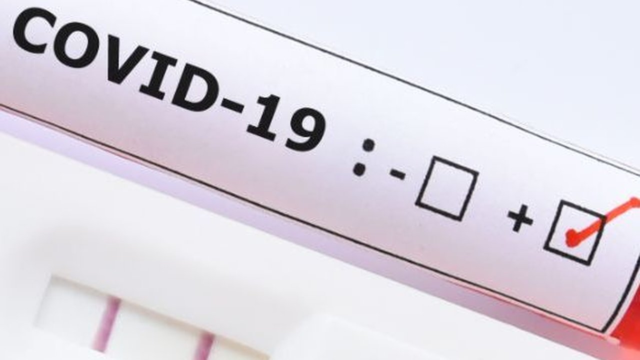 WNI di Jepang Meninggal Dunia Akibat Covid-19