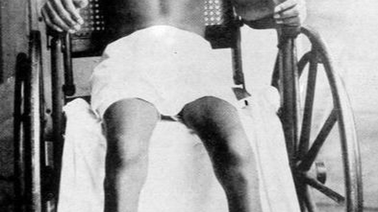 Penyebab Penyakit Beri-beri yang Perlu Diwaspadai, Begini Cara Mengatasinya