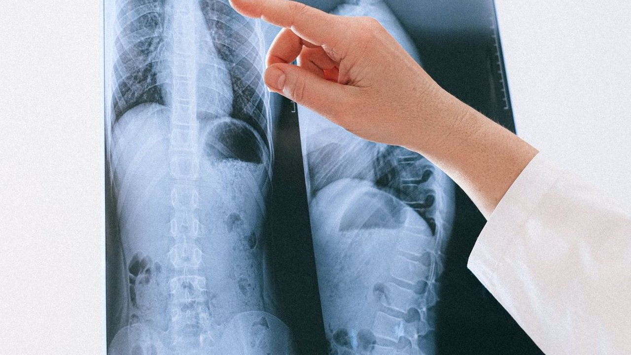 Fungsi Alveolus pada Organ Pernapasan, Ketahui Struktur dan Gangguannya