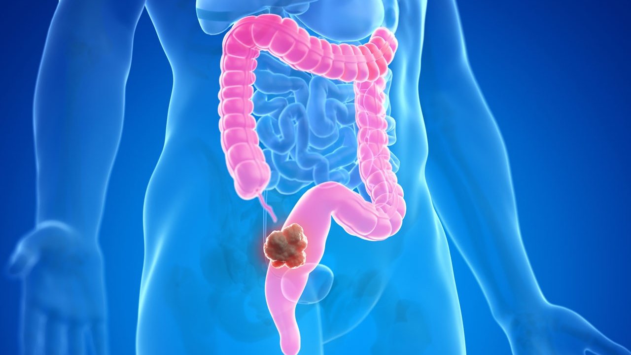 Tapak Dara: Rahasia Alam untuk Kesehatan Optimal dan Penyembuhan Penyakit