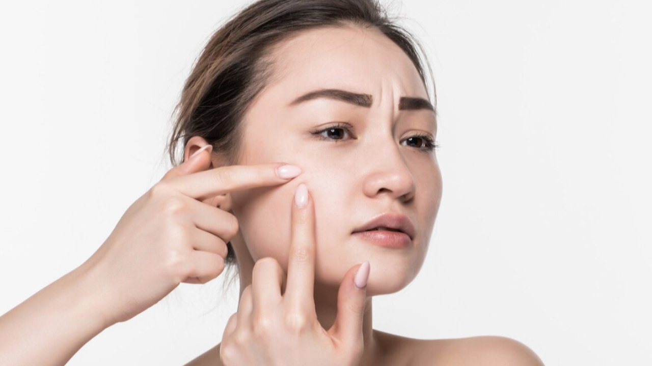 Cara Merawat Kulit Sensitif agar Terhindar dari Iritasi