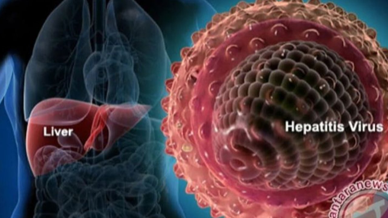 hepatitis
