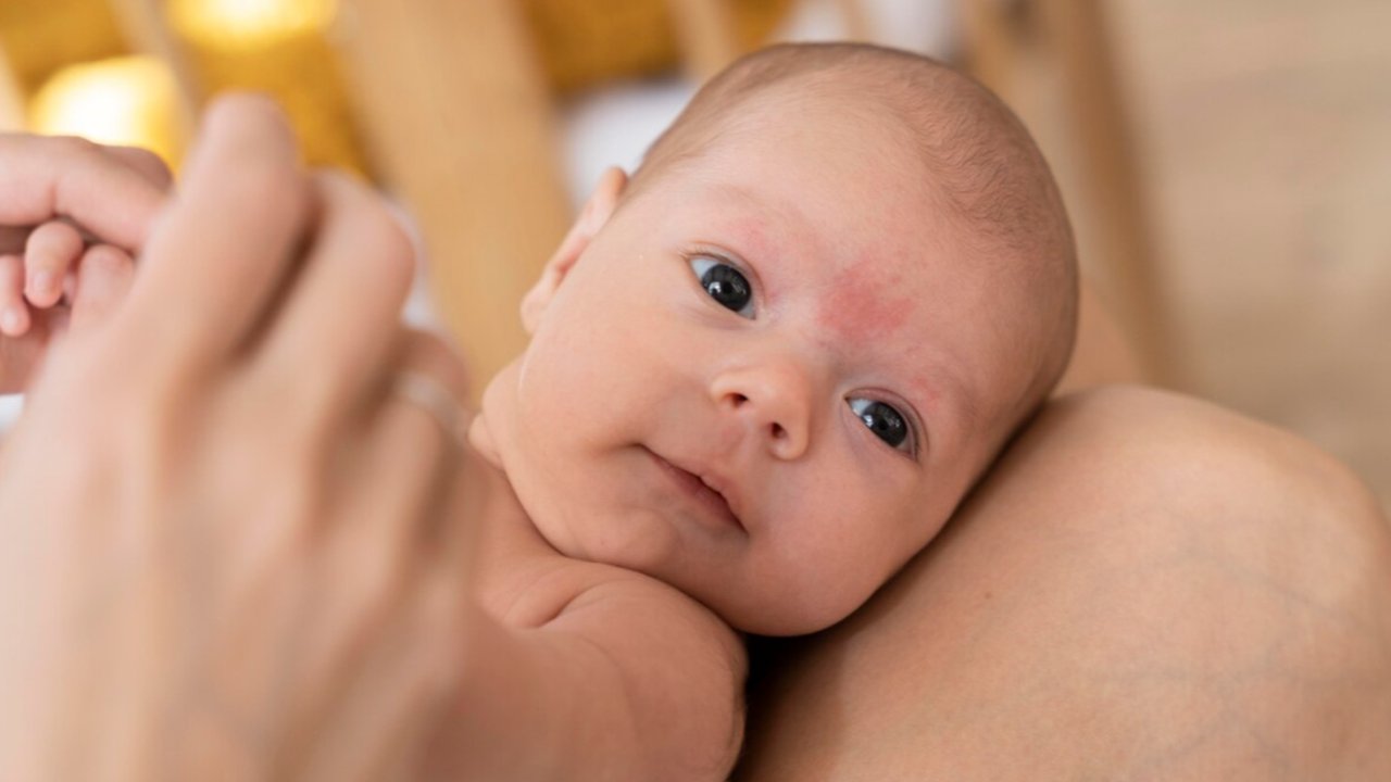 Haruskah Menggunduli Rambut Bayi? Ketahui Dampaknya pada Perumbuhan Rambut Bayi