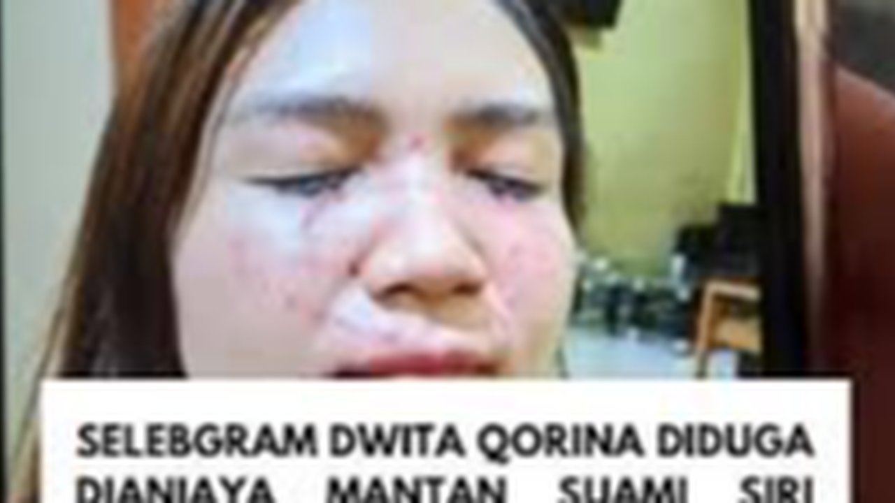 Selebgram di Lombok dianiaya
