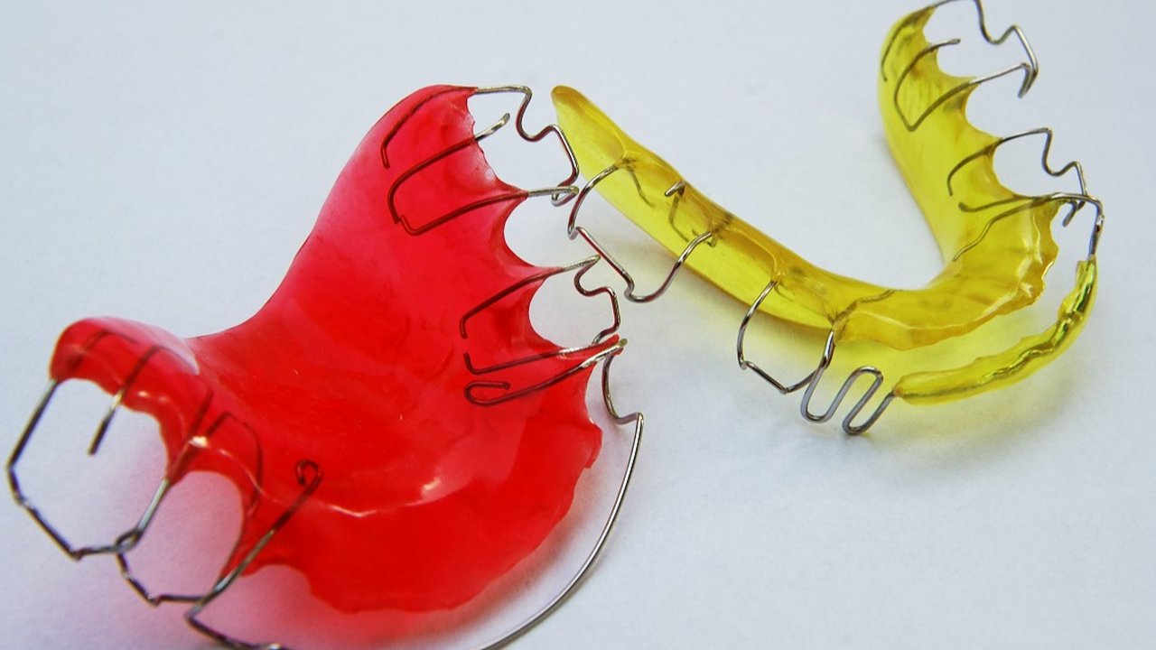 Ilustrasi Retainer