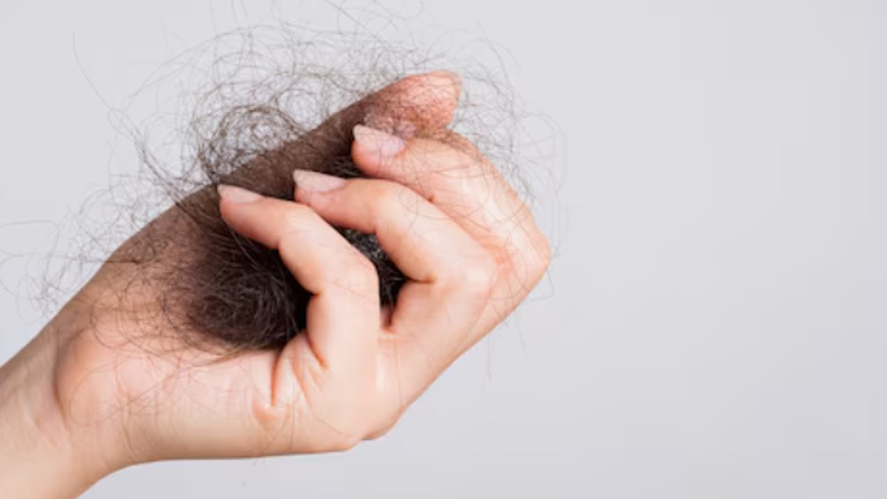 Rambut Kering dan Rusak? Ini Dia 5 Solusi Terbaik untuk Memperbaikinya