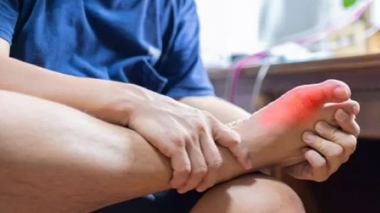 Nyeri Asam Urat. (foto: Pinterest/JawaPos).