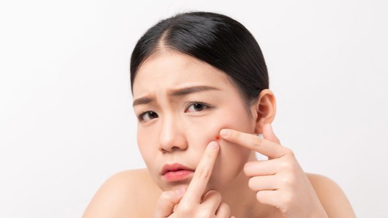 Punya Kulit Berjerawat? Simak Urutan Skincare Malam yang Paling Efektif untuk Hasil Maksimal
