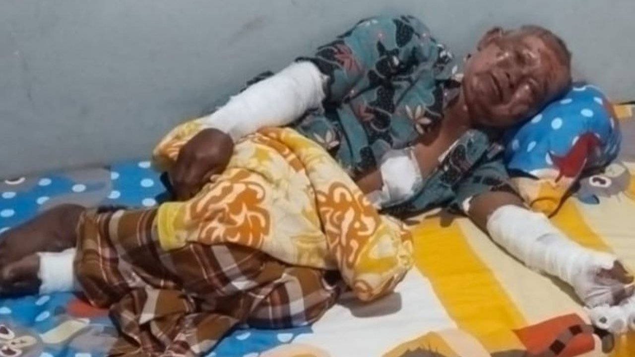 Keponakan Tega Bakar Paman Sendiri di Kamar