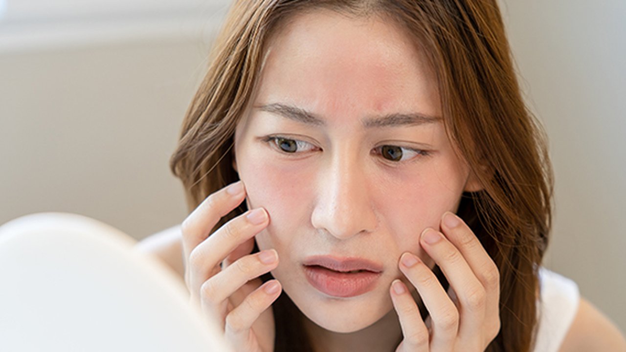 Wanita dengan masalah dermatitis atopik.