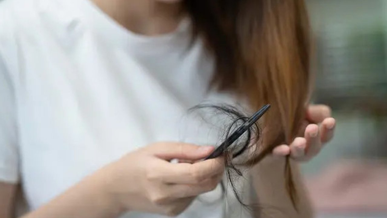 Ilustrasi rambut rontok ketika menyusui. (c) chormail@hotmail/Depositphotos.com