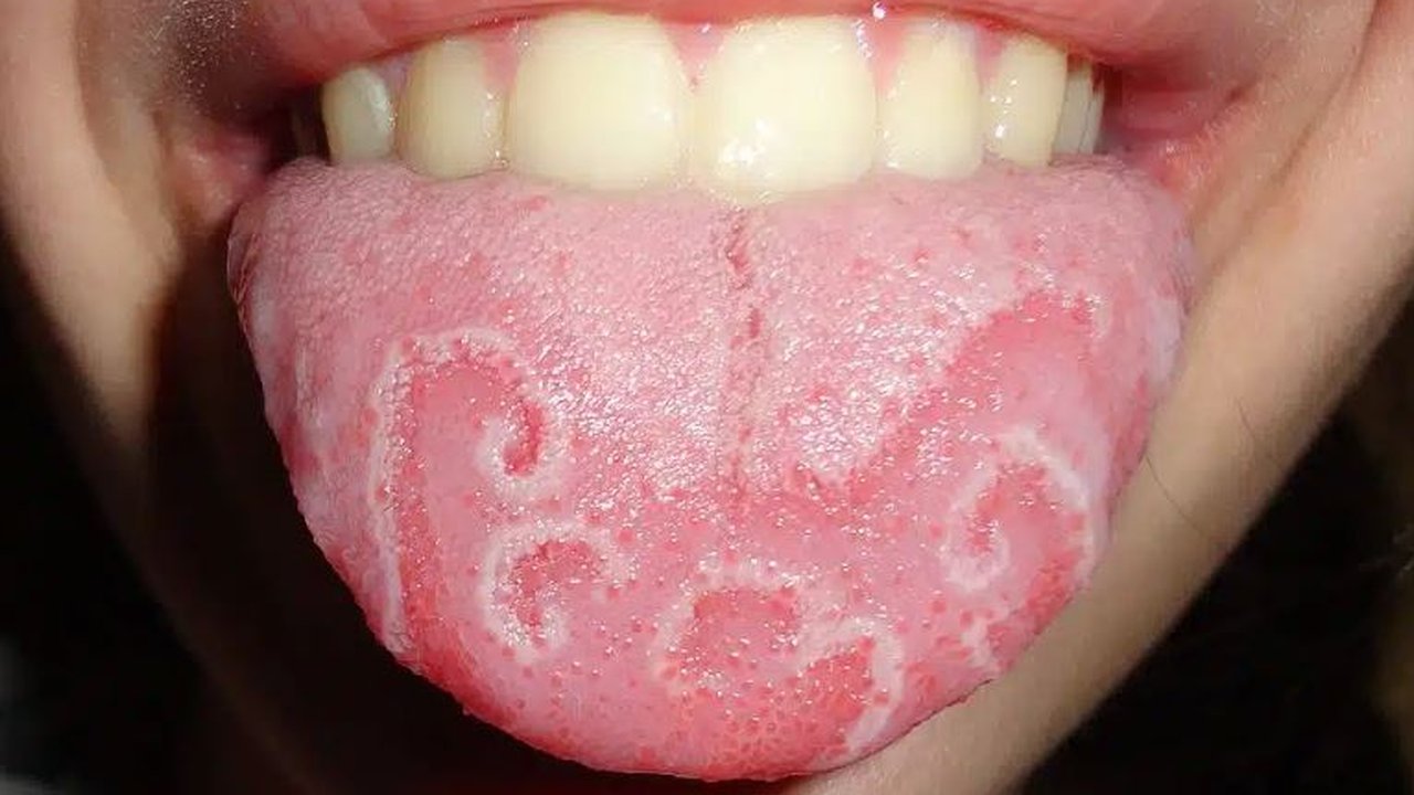 Wanita pemilik lidah terlebar di dunia. (Dok: Guinness World Records)