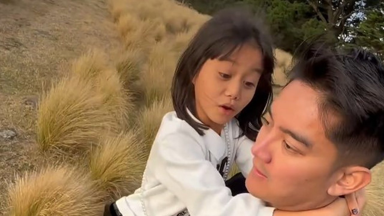 Boy William Kena Ulti Keponakan, Disebut Punya Hidung Palsu