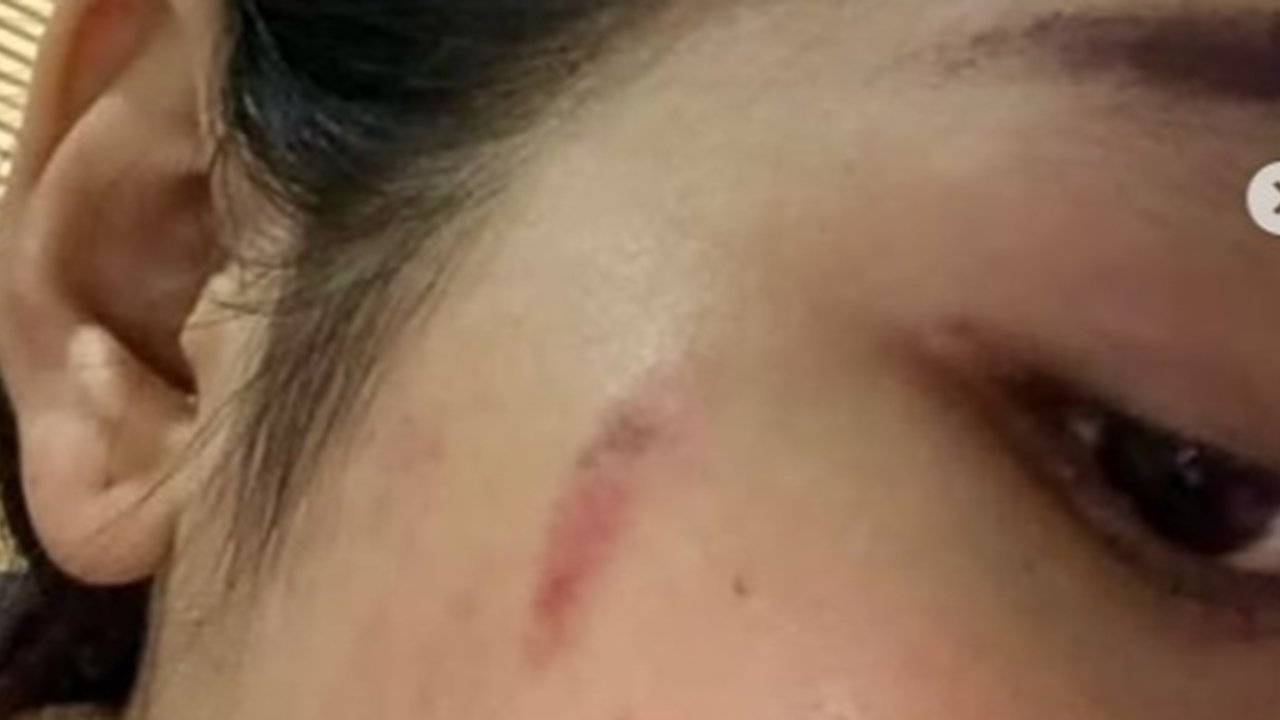 Wanita Mengaku Diniaya Polisi