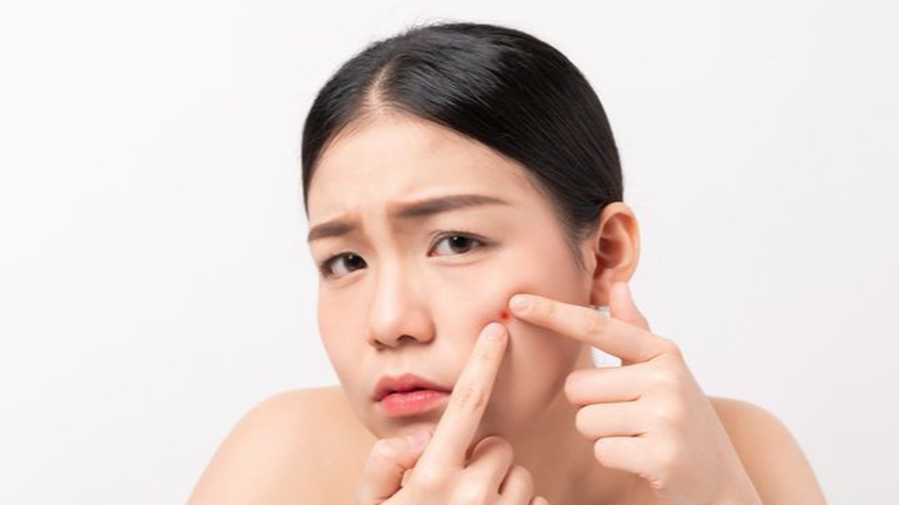 Punya Kulit Berjerawat? Simak Urutan Skincare Malam yang Paling Efektif untuk Hasil Maksimal