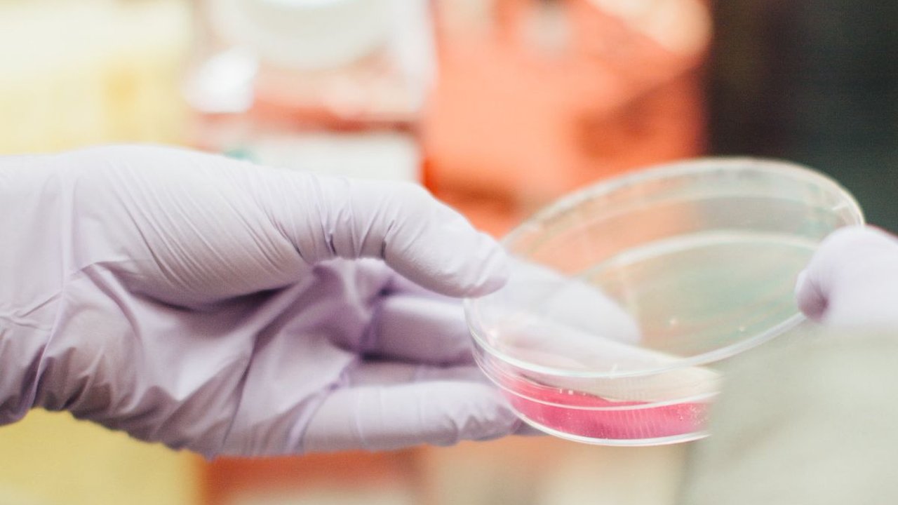 Mengenal Apa Itu Feromon, Zat Kimia Pemikat Lawan Jenis