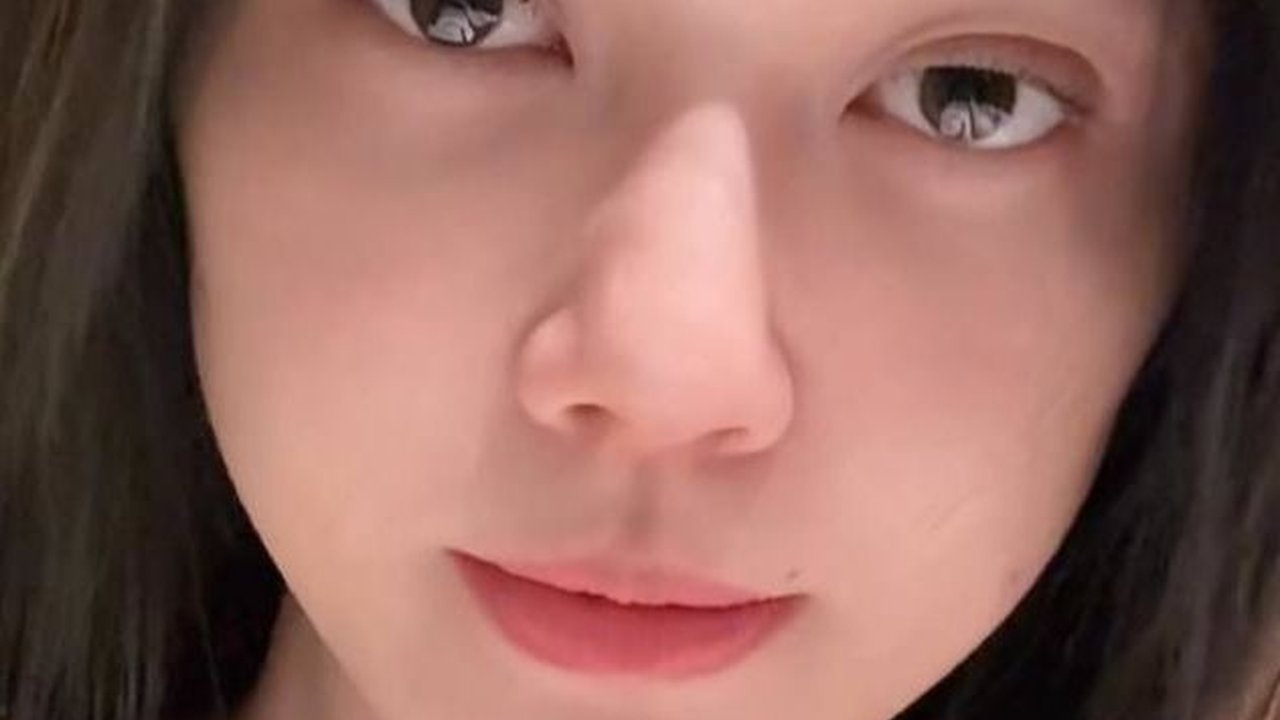 Tetap Menawan Meski Wajah Berminyak, Ini Potret Nita Gunawan Percaya Diri Tampil Bare Face