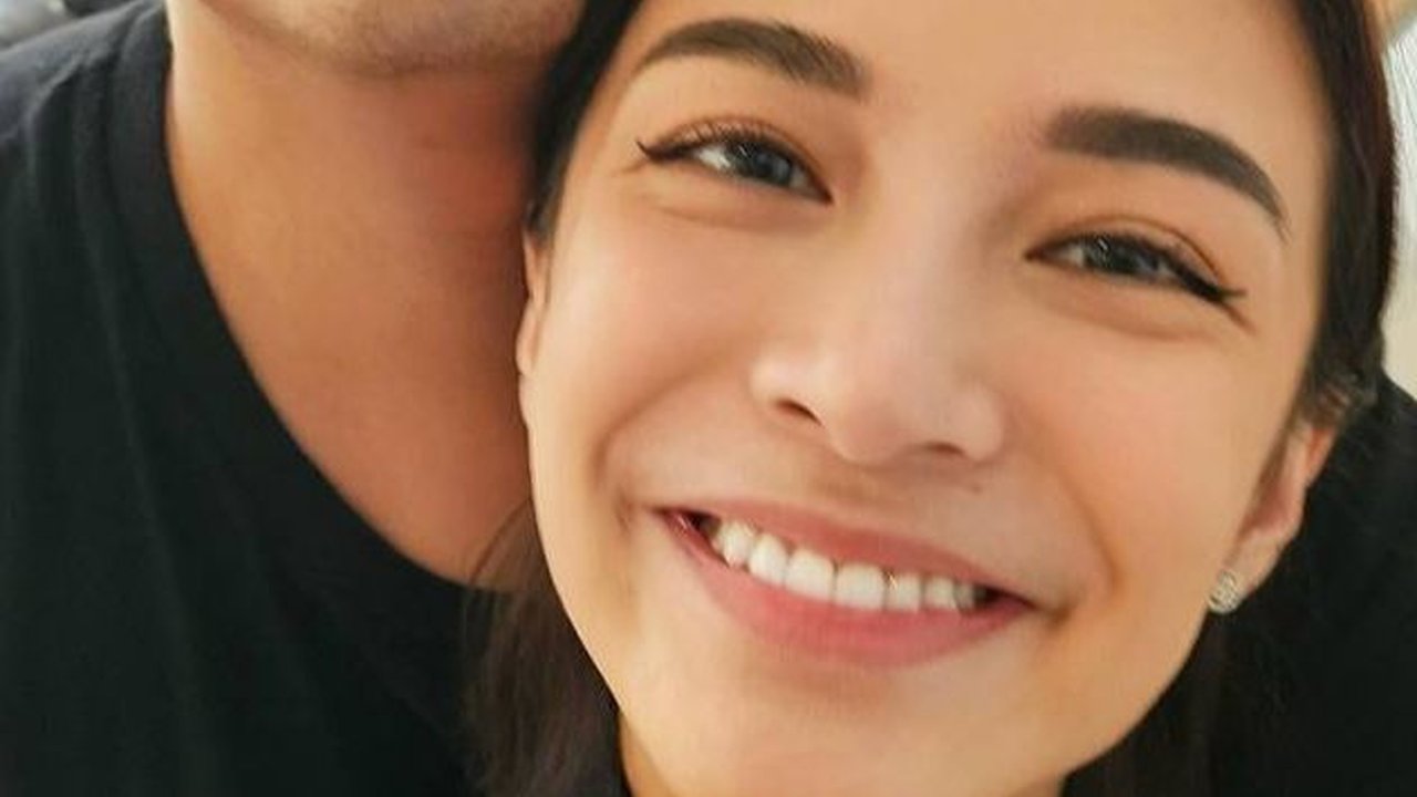 Potret Terbaru Chelsea Olivia, Perawatan Gigi Gingsulnya Makin Rapi