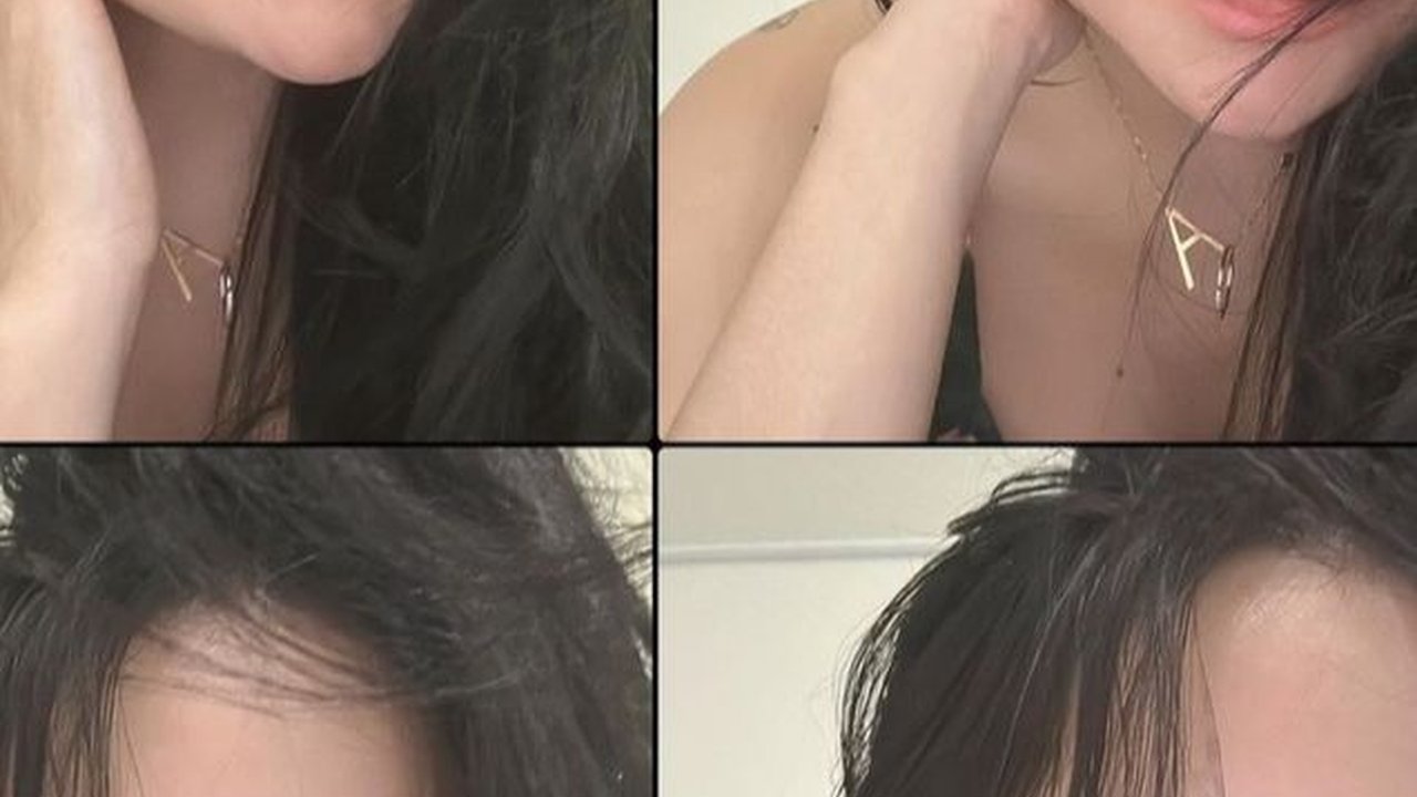 Potret Terbaru Mawar AFI Usai Jalani Oplas Hidung di Korea Selatan, Penampilan Barunya Jadi Sorotan