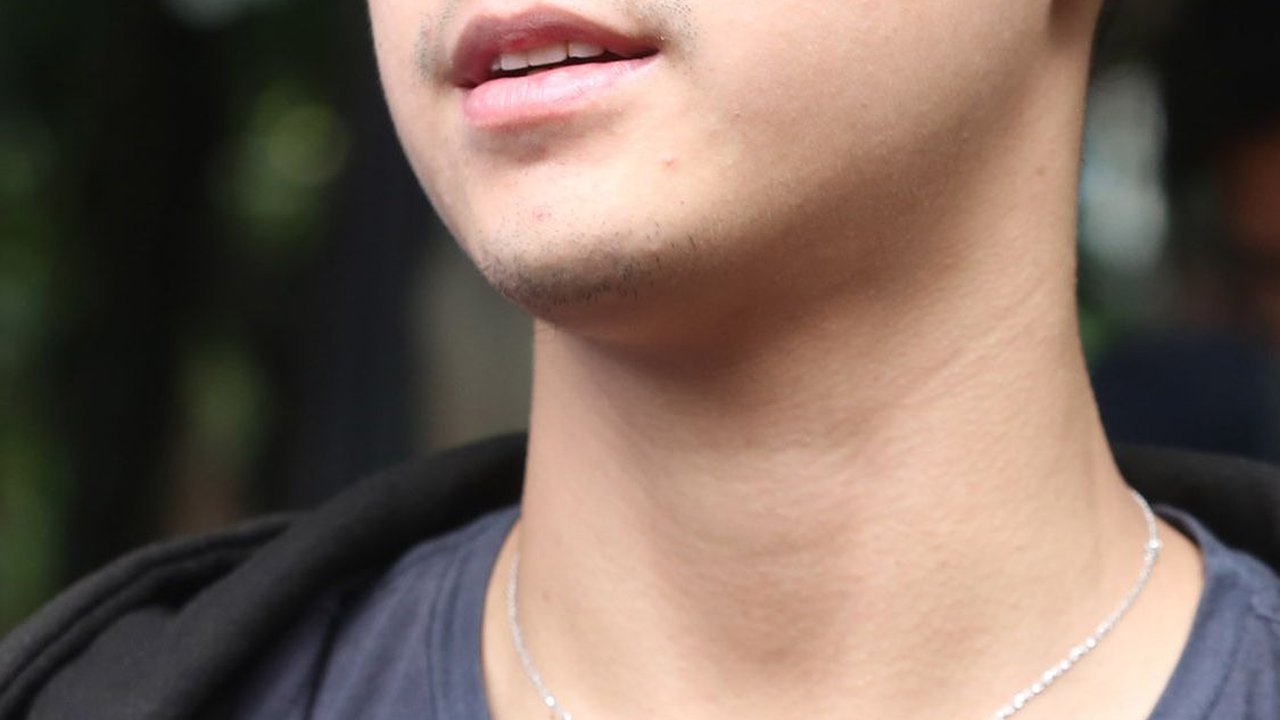 Al Ghazali Tiba-tiba Unggah Foto Bercucuran 'Darah', Kenapa?
