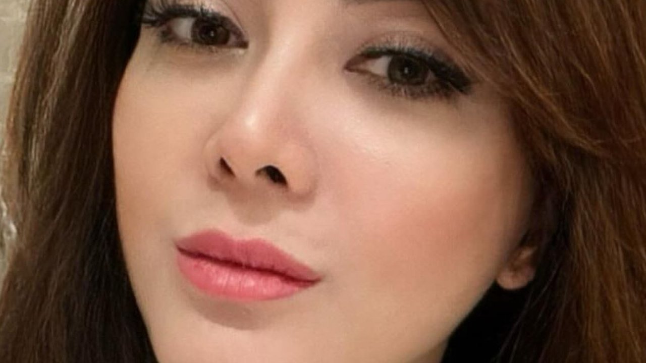 Foto-foto Terbaru Dhena Devanka Usai Jalani Oplas di Korea Selatan, Penampilannya Disebut Makin 'Cetar'