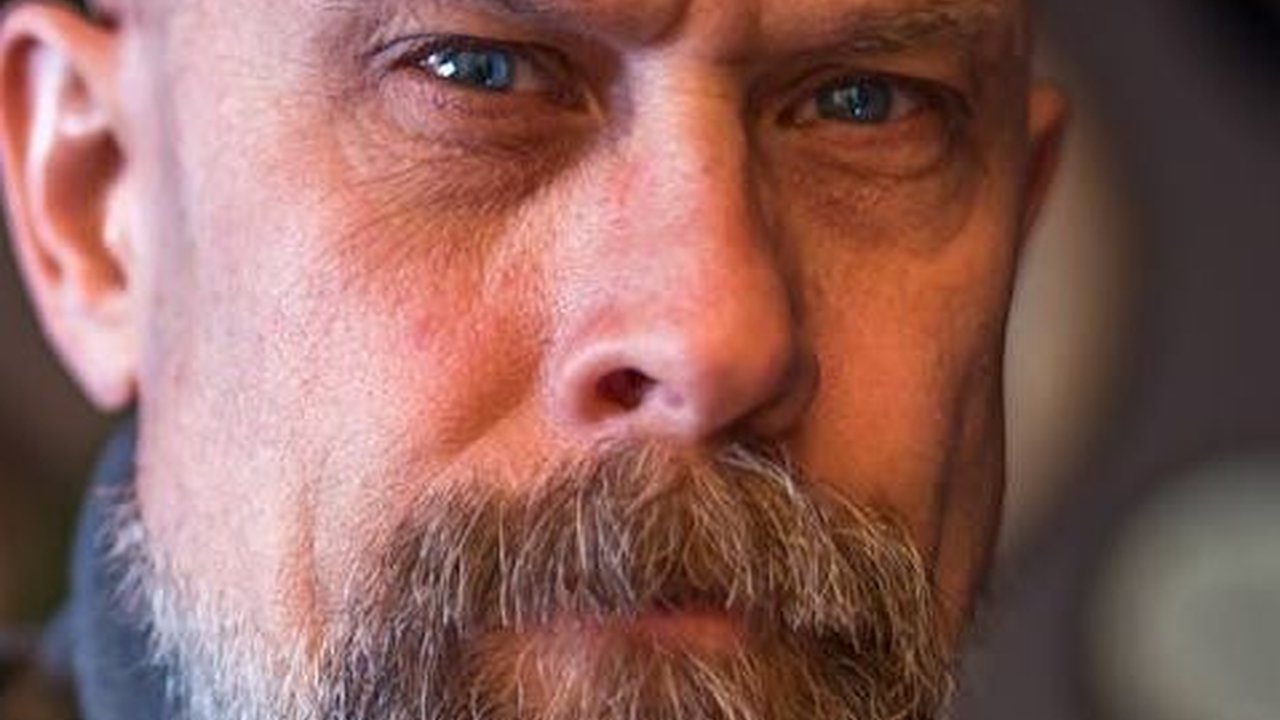 Kenali Tiga Jenis Kebotakan yang Rentan Dialami oleh Masyarakat