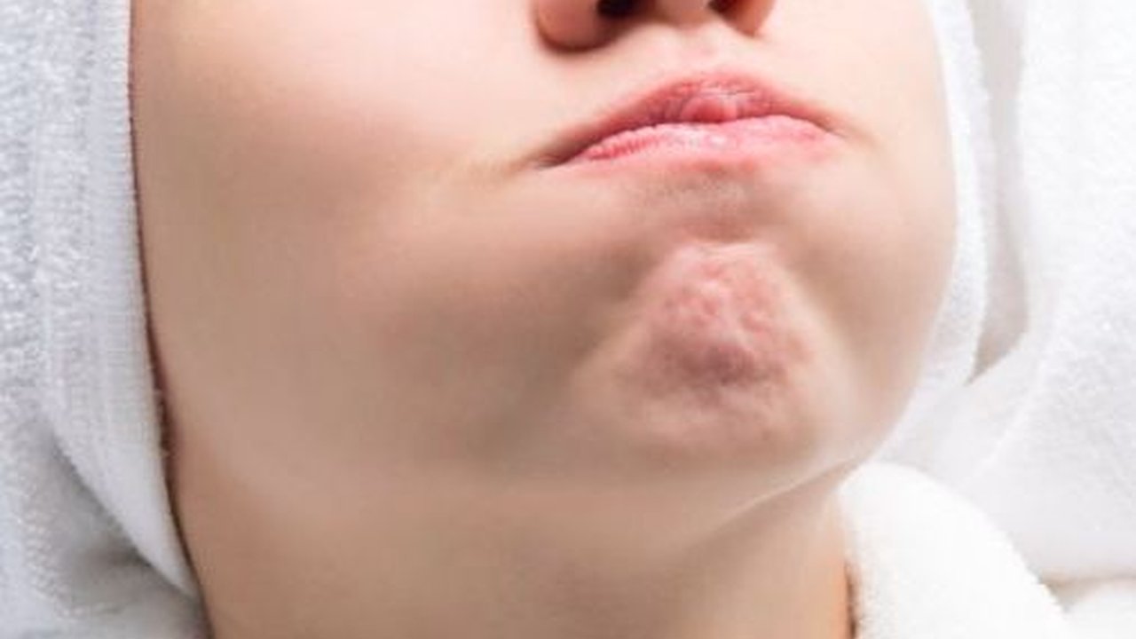 Cara Mengatasi Lidah Pahit Saat Berpuasa, Pahami Berbagai Penyebabnya