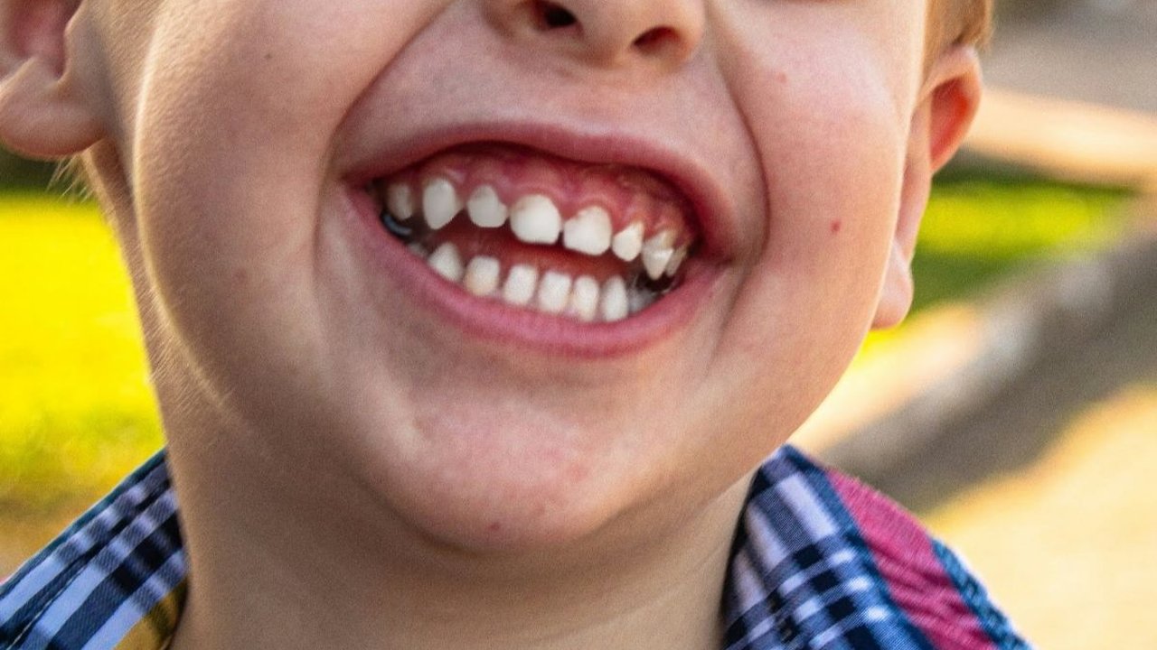 Quote Lucu tentang Teman, Cara Mudah Ekspresikan Persahabatan dengan Tawa