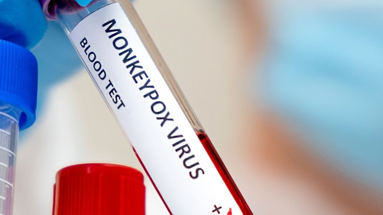 Mengenal cacar monyet, dari penyebab, cara penularan dan cara mencegahnya