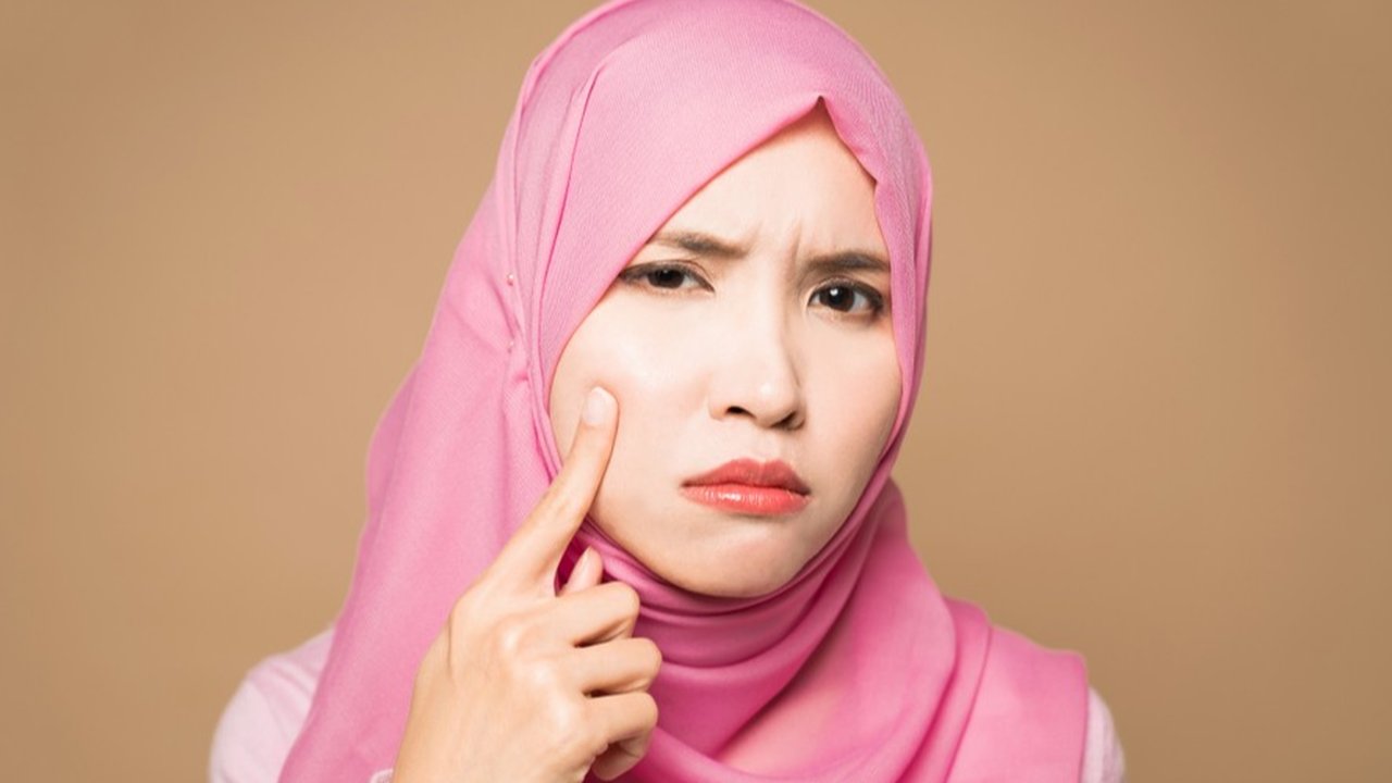 Doa Penghilang Jerawat dan Bekasnya