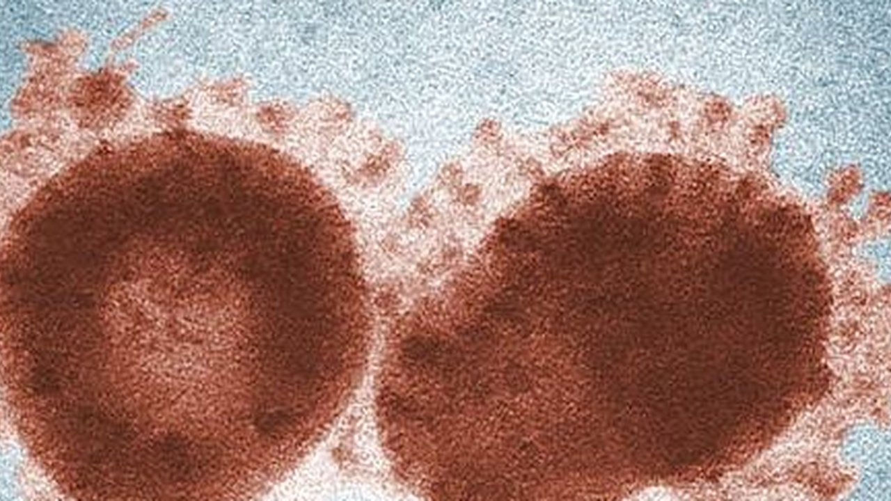 Ilustrasi virus. (Unsplash)