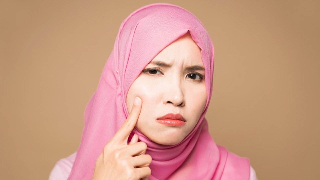 Doa Penghilang Jerawat dan Bekasnya