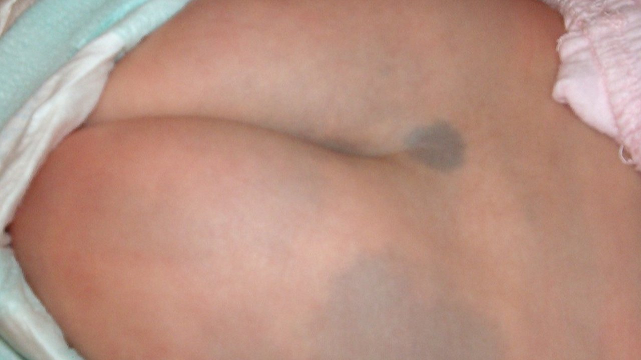 Mongolian Blue Spot
