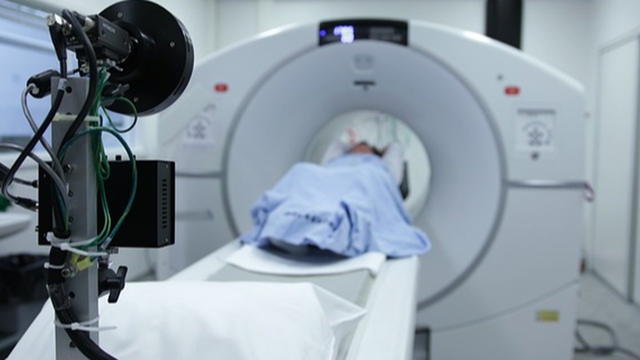 ct scan