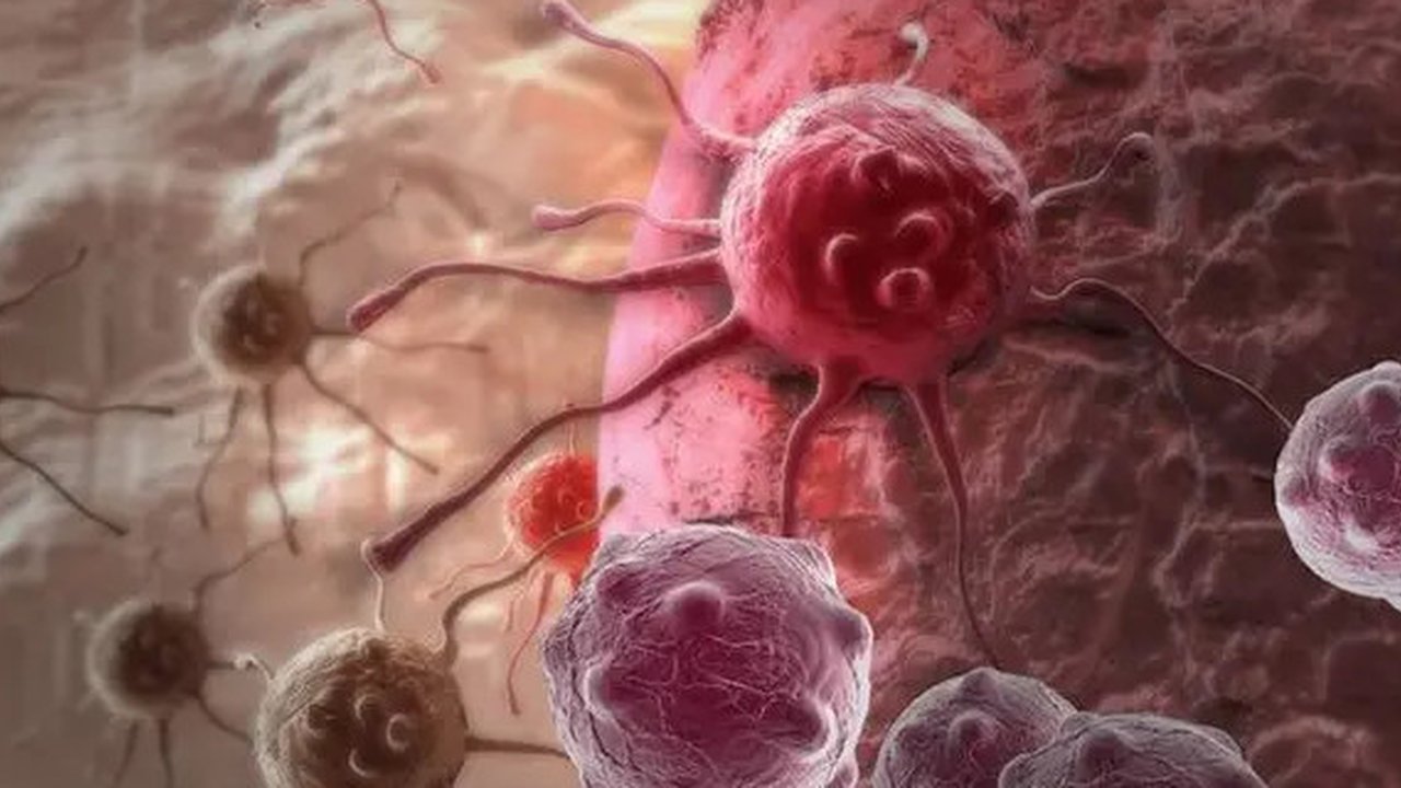 Ilustrasi sel kanker | Klikdokter